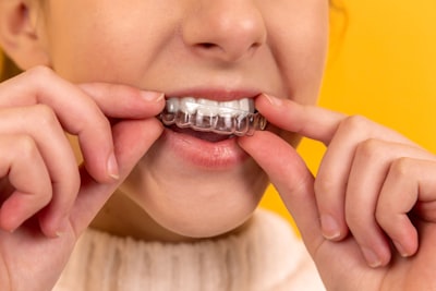 Smile makeover Miami