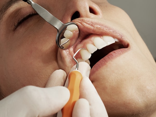Porcelain Veneers Miami